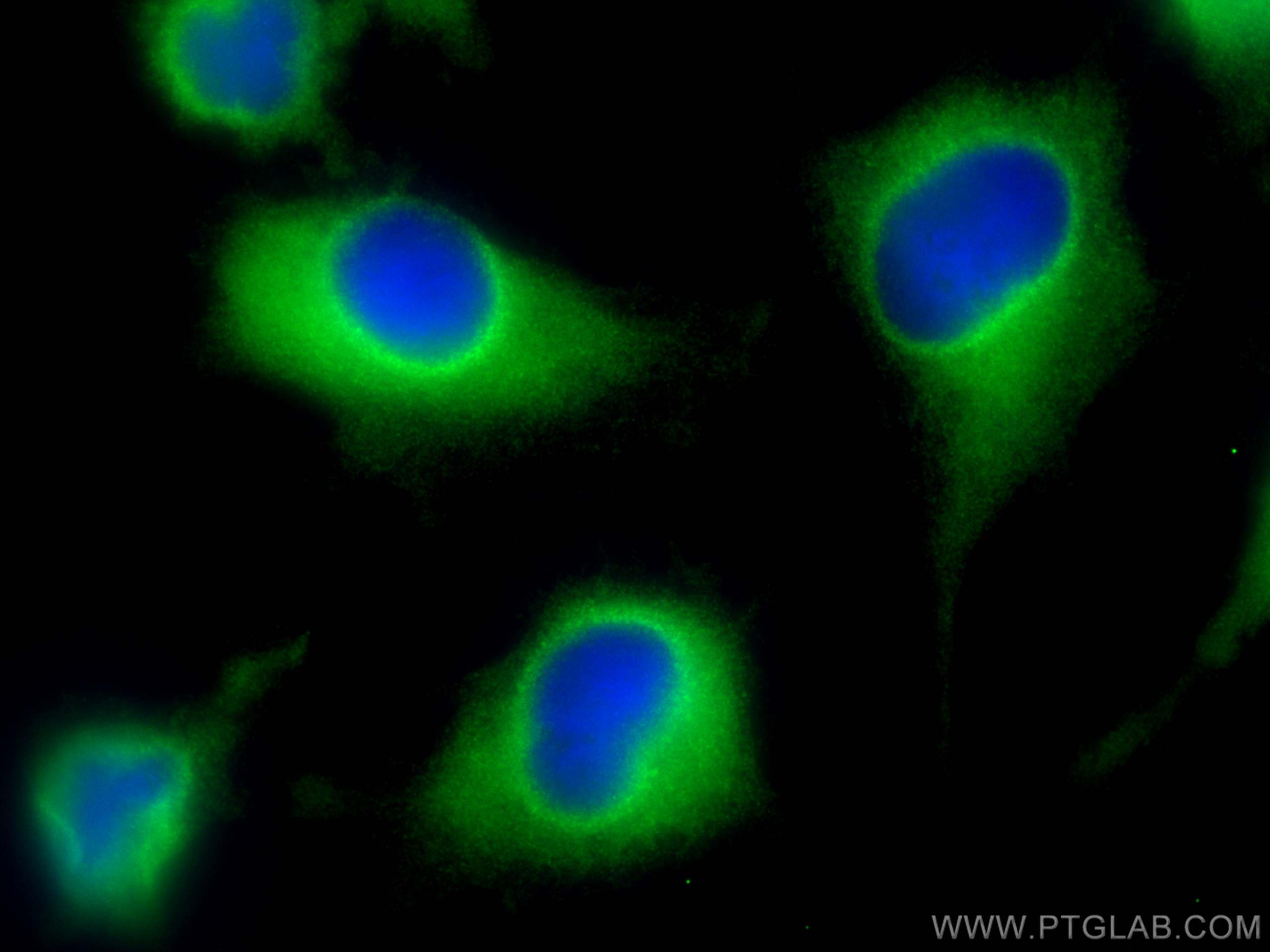 Immunofluorescence (IF) / fluorescent staining of U-251 cells using TEX264 Polyclonal antibody (25858-1-AP)