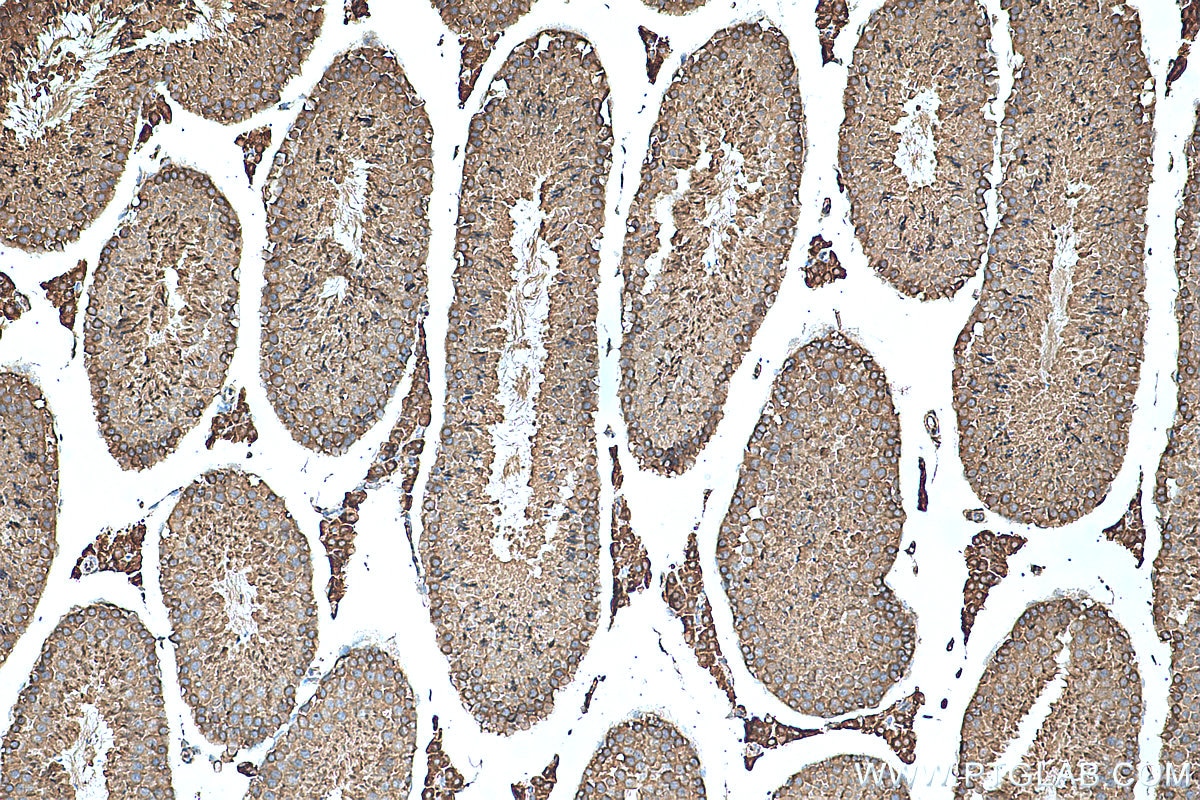 Immunohistochemistry (IHC) staining of mouse testis tissue using TEX264 Polyclonal antibody (25858-1-AP)