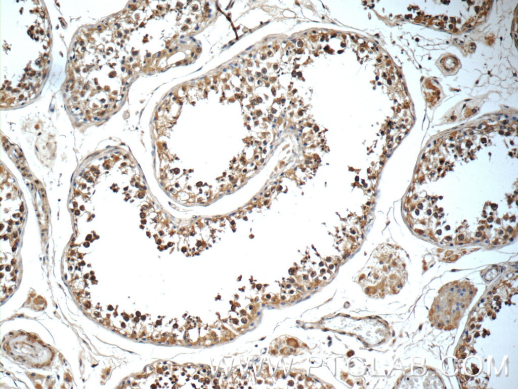 Immunohistochemistry (IHC) staining of human testis tissue using TEX264 Polyclonal antibody (25858-1-AP)