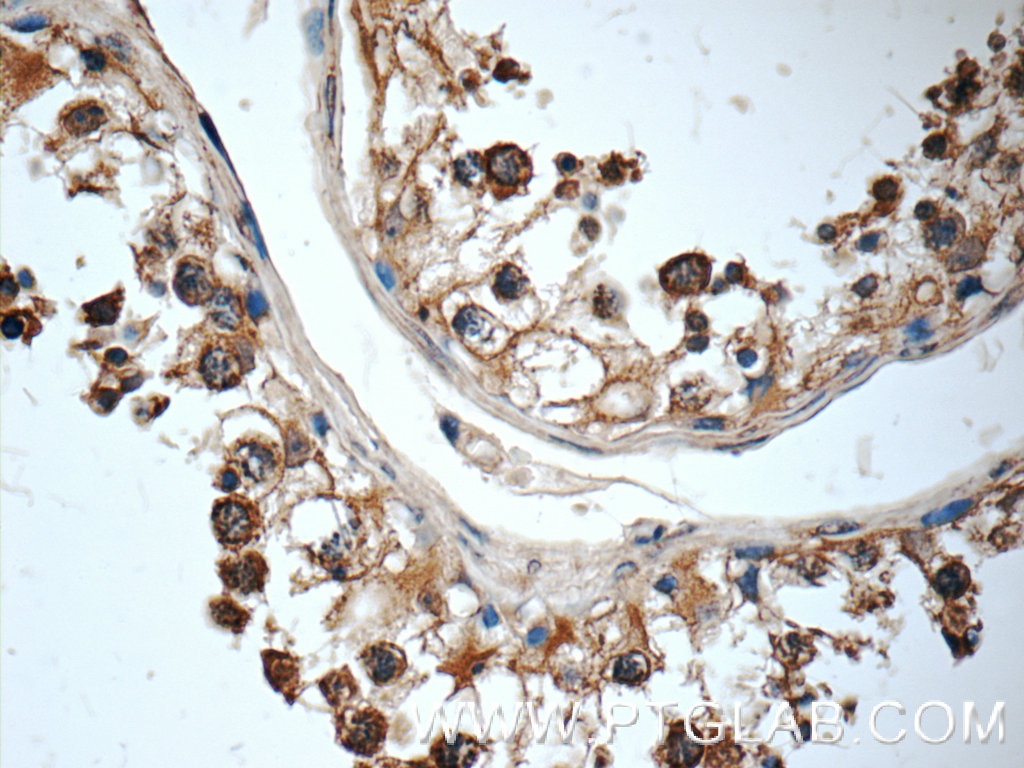 Immunohistochemistry (IHC) staining of human testis tissue using TEX264 Polyclonal antibody (25858-1-AP)