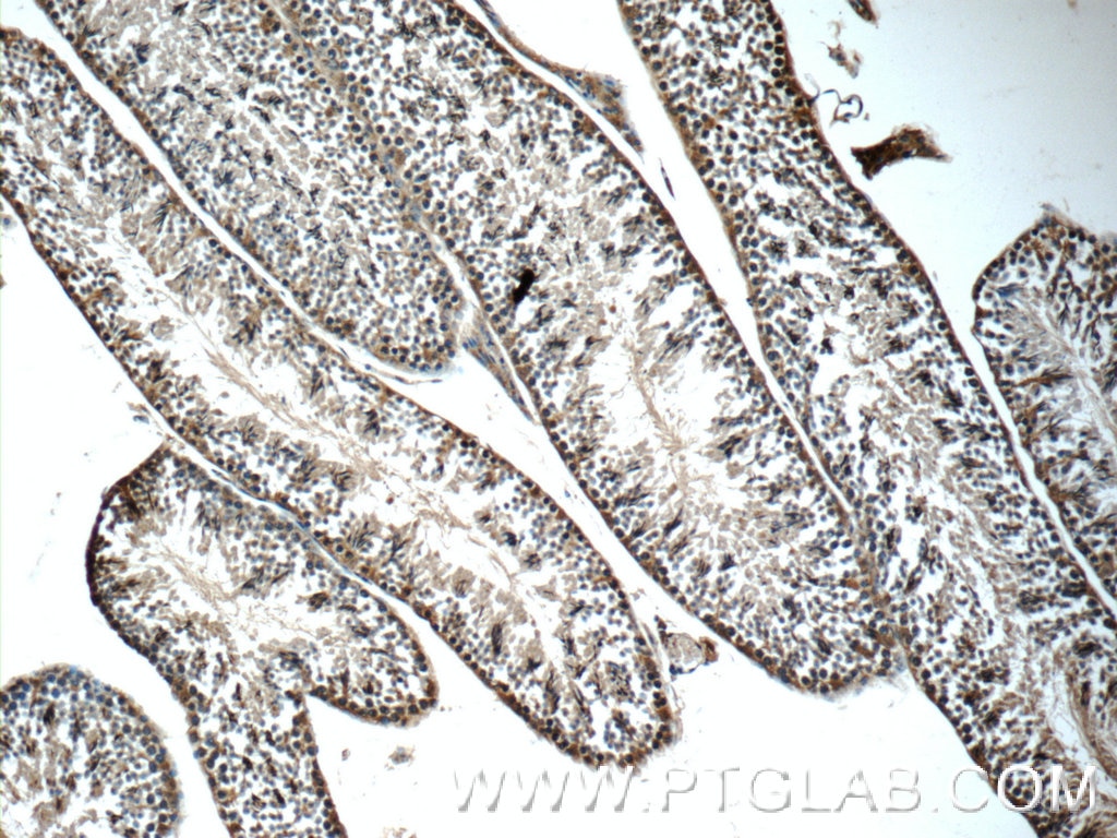 Immunohistochemistry (IHC) staining of mouse testis tissue using TEX264 Polyclonal antibody (25858-1-AP)