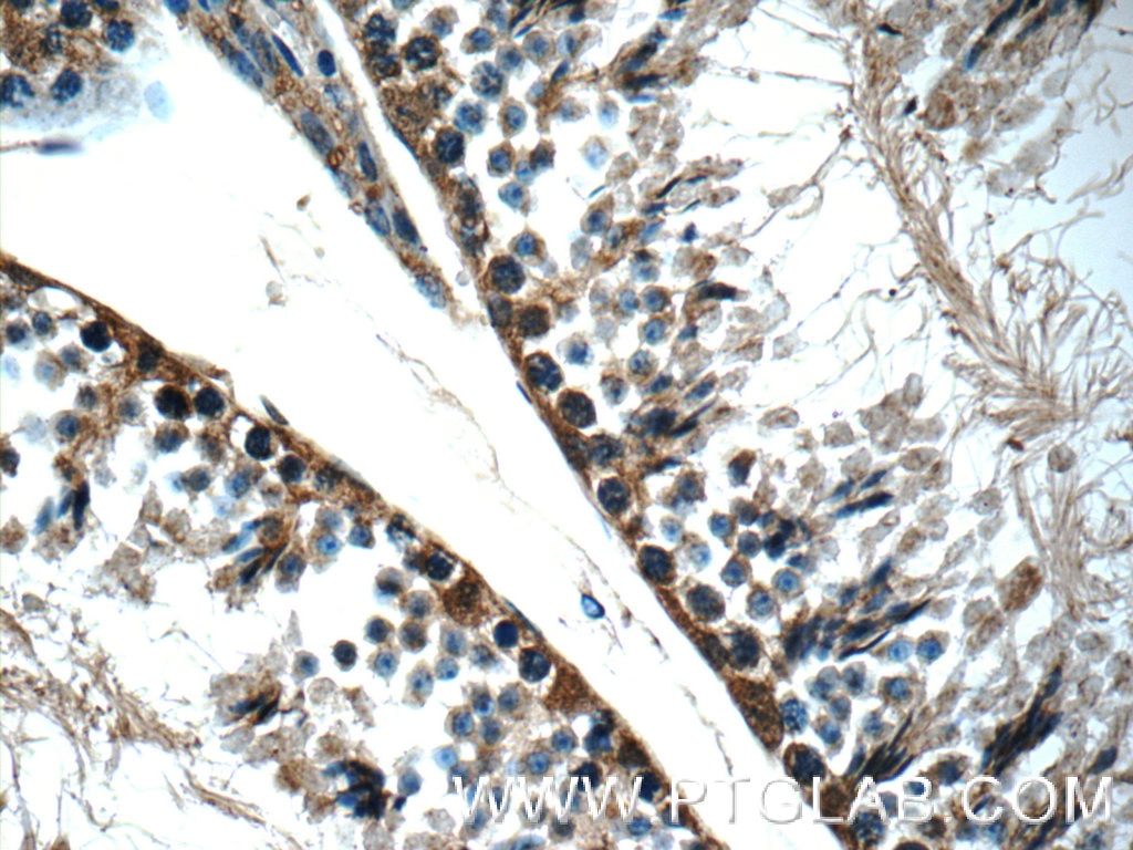 Immunohistochemistry (IHC) staining of mouse testis tissue using TEX264 Polyclonal antibody (25858-1-AP)