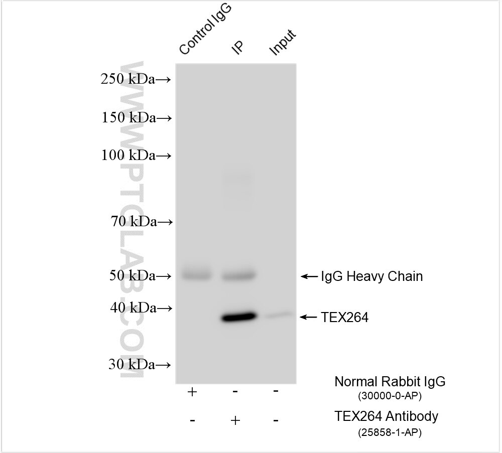 Immunoprecipitation (IP) experiment of HEK-293 cells using TEX264 Polyclonal antibody (25858-1-AP)