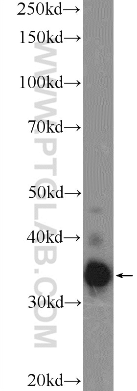 Western Blot (WB) analysis of mouse testis tissue using TEX264 Polyclonal antibody (25858-1-AP)