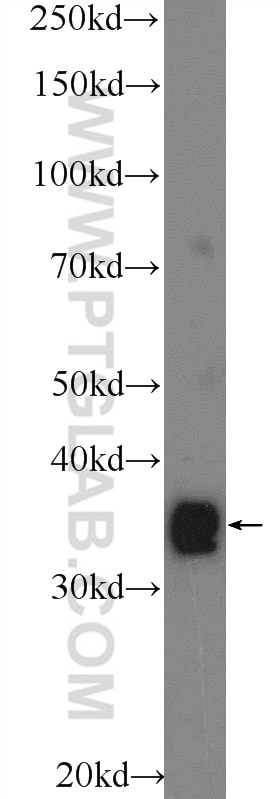 Western Blot (WB) analysis of mouse brain tissue using TEX264 Polyclonal antibody (25858-1-AP)