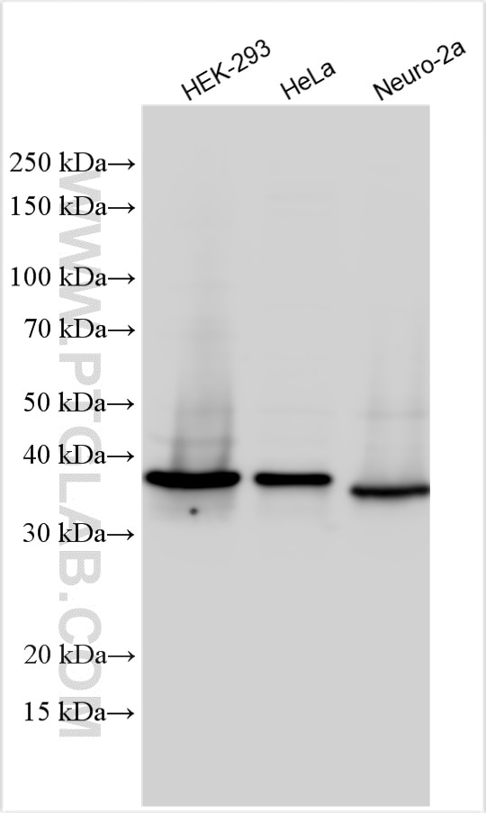 Western Blot (WB) analysis of various lysates using TEX264 Polyclonal antibody (25858-1-AP)