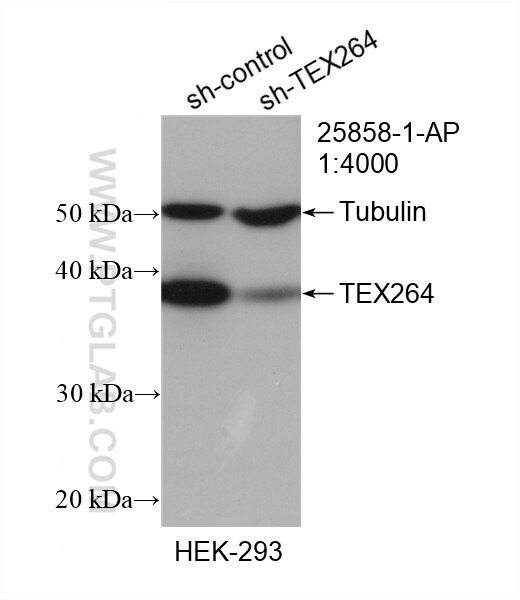 Western Blot (WB) analysis of HEK-293 cells using TEX264 Polyclonal antibody (25858-1-AP)