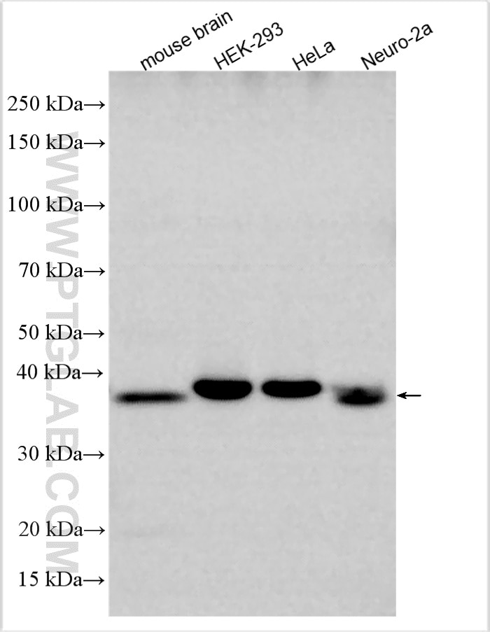 Western Blot (WB) analysis of various lysates using TEX264 Polyclonal antibody (25858-1-AP)