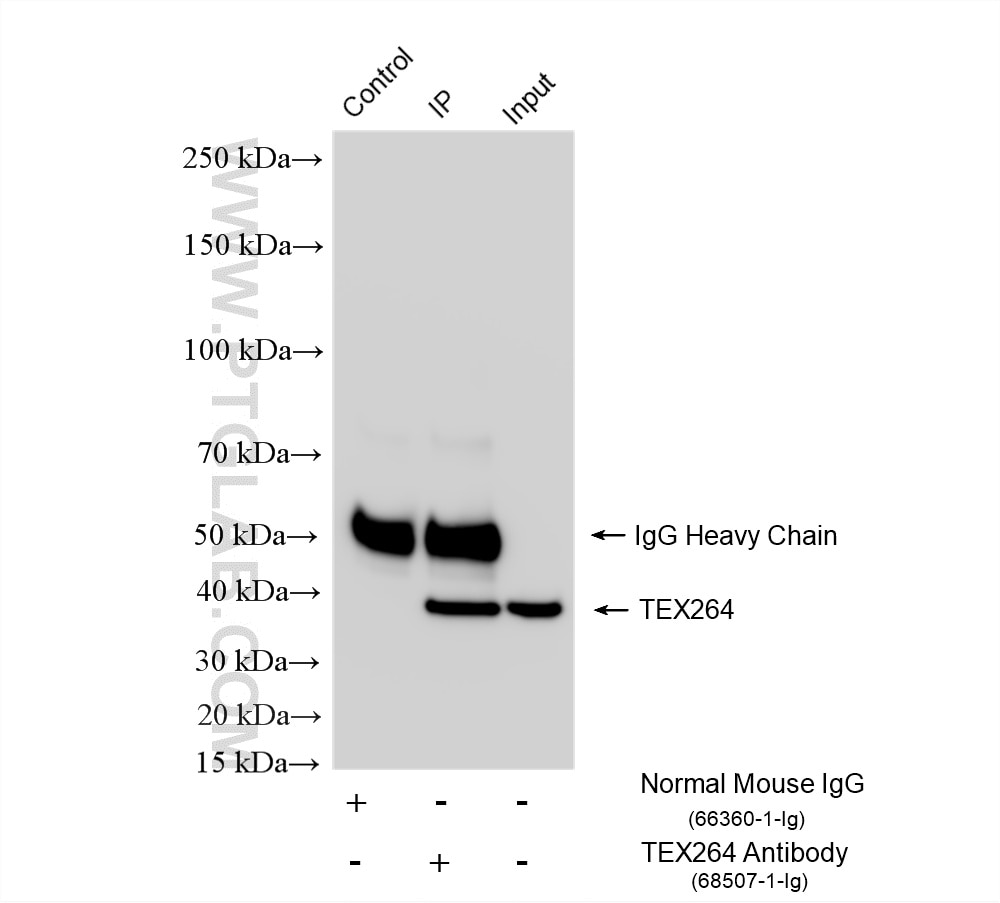 IP experiment of A549 using 68507-1-Ig (same clone as 68507-1-PBS) Immunoprecipitation (IP) experiment of A549 cells using TEX264 Monoclonal antibody (68507-1-Ig)
