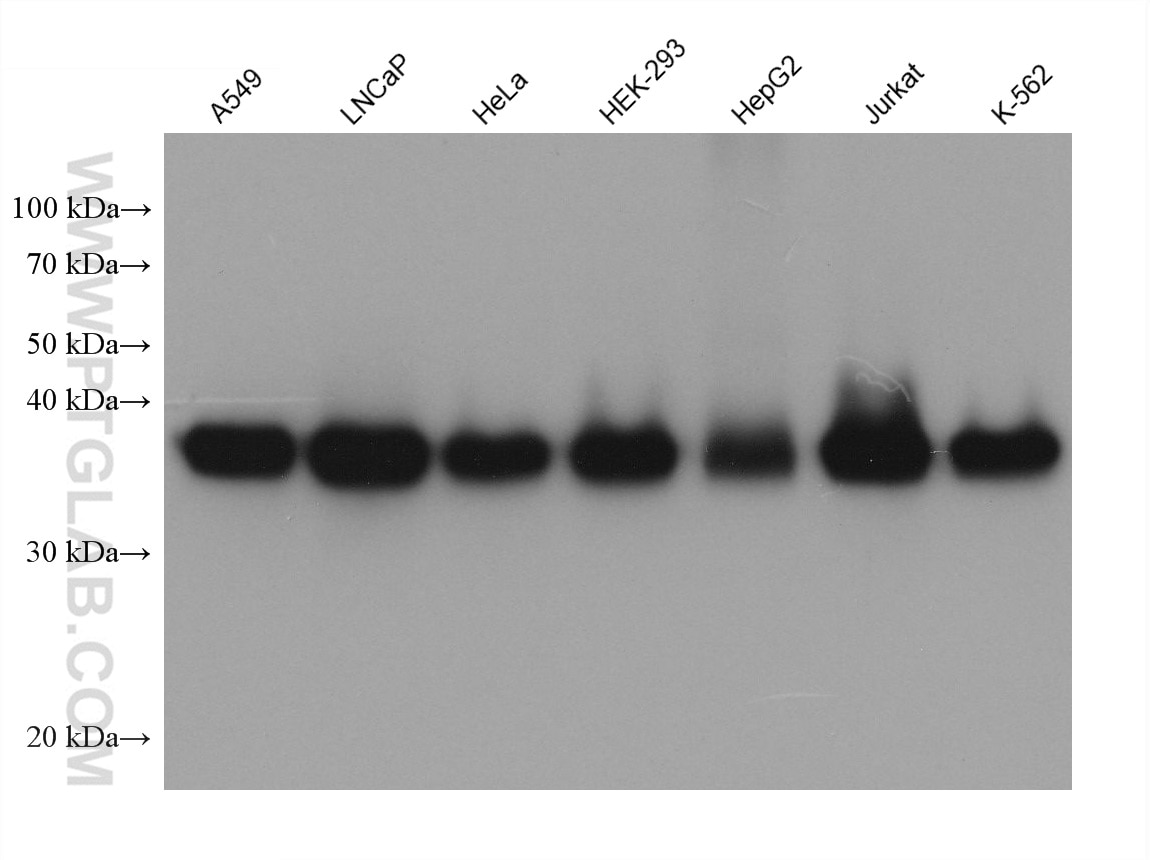 Western Blot (WB) analysis of various lysates using TEX264 Monoclonal antibody (68507-1-Ig)