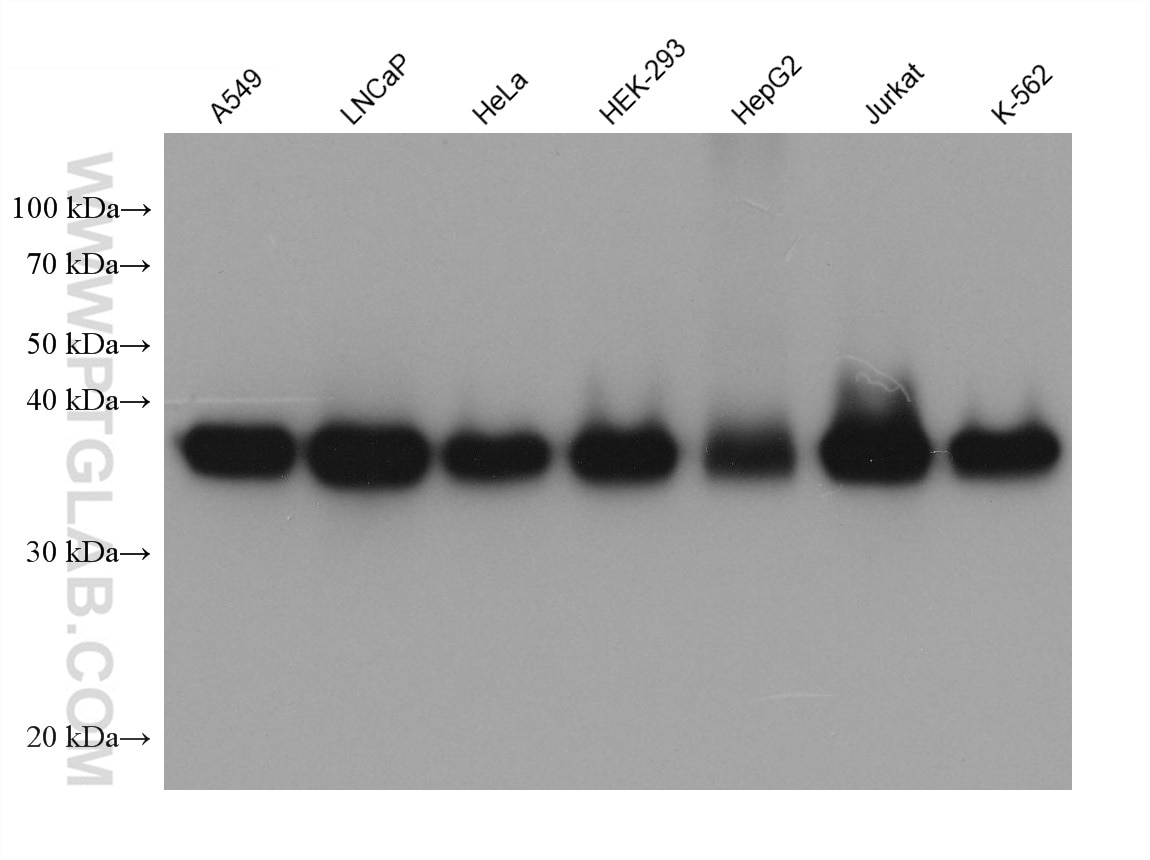 WB analysis using 68507-1-Ig