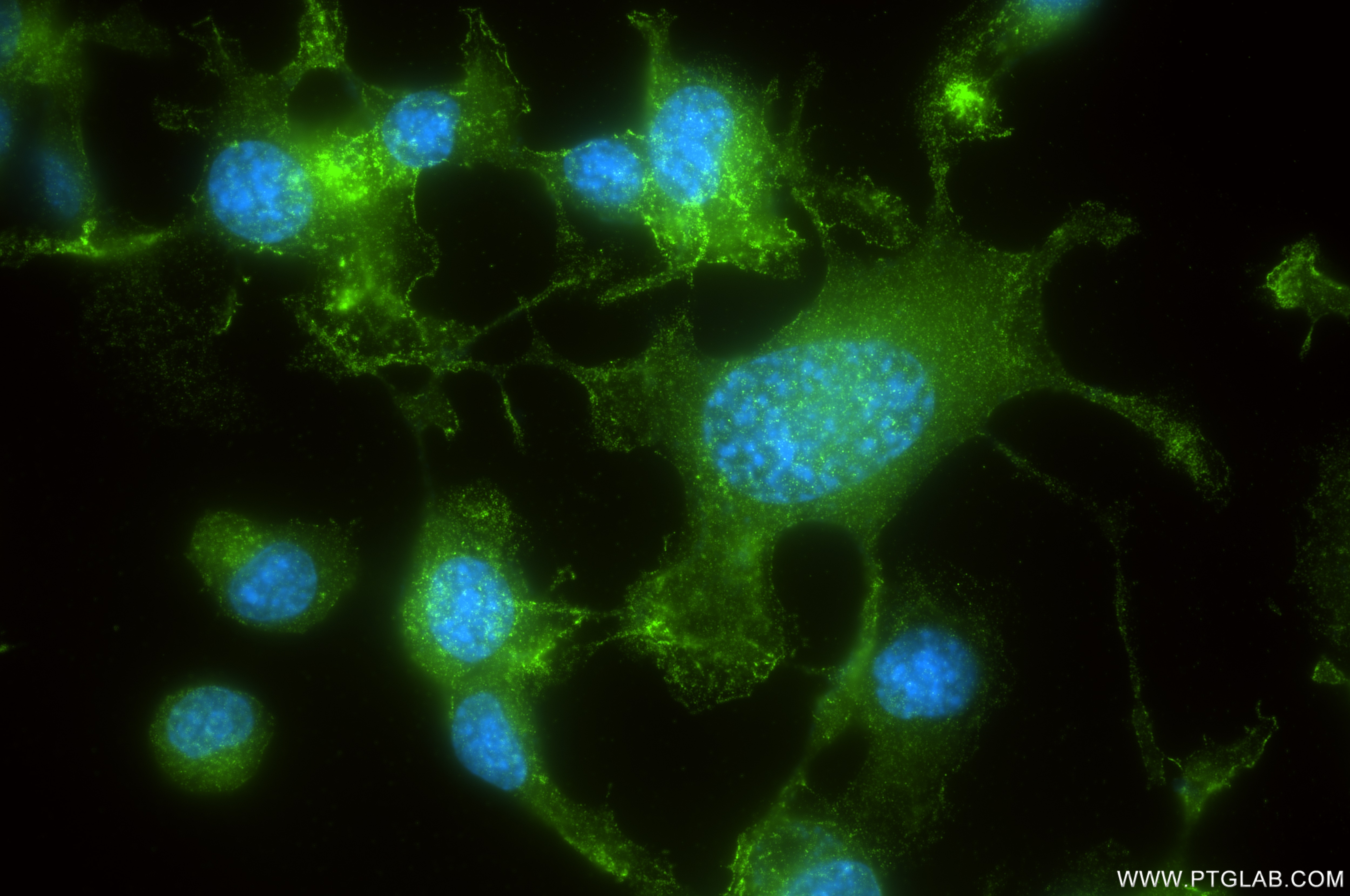 Immunofluorescent analysis of (-20°C Ethanol) fixed Neuro-2a cells using TEX264 antibody (84946-5-RR, Clone: 242500B3 ) at dilution of 1:400 and CoraLite®488-Conjugated Goat Anti-Rabbit IgG(H+L) (SA00013-2). Immunofluorescence (IF) / fluorescent staining of Neuro-2a cells using TEX264 Recombinant antibody (84946-5-RR)