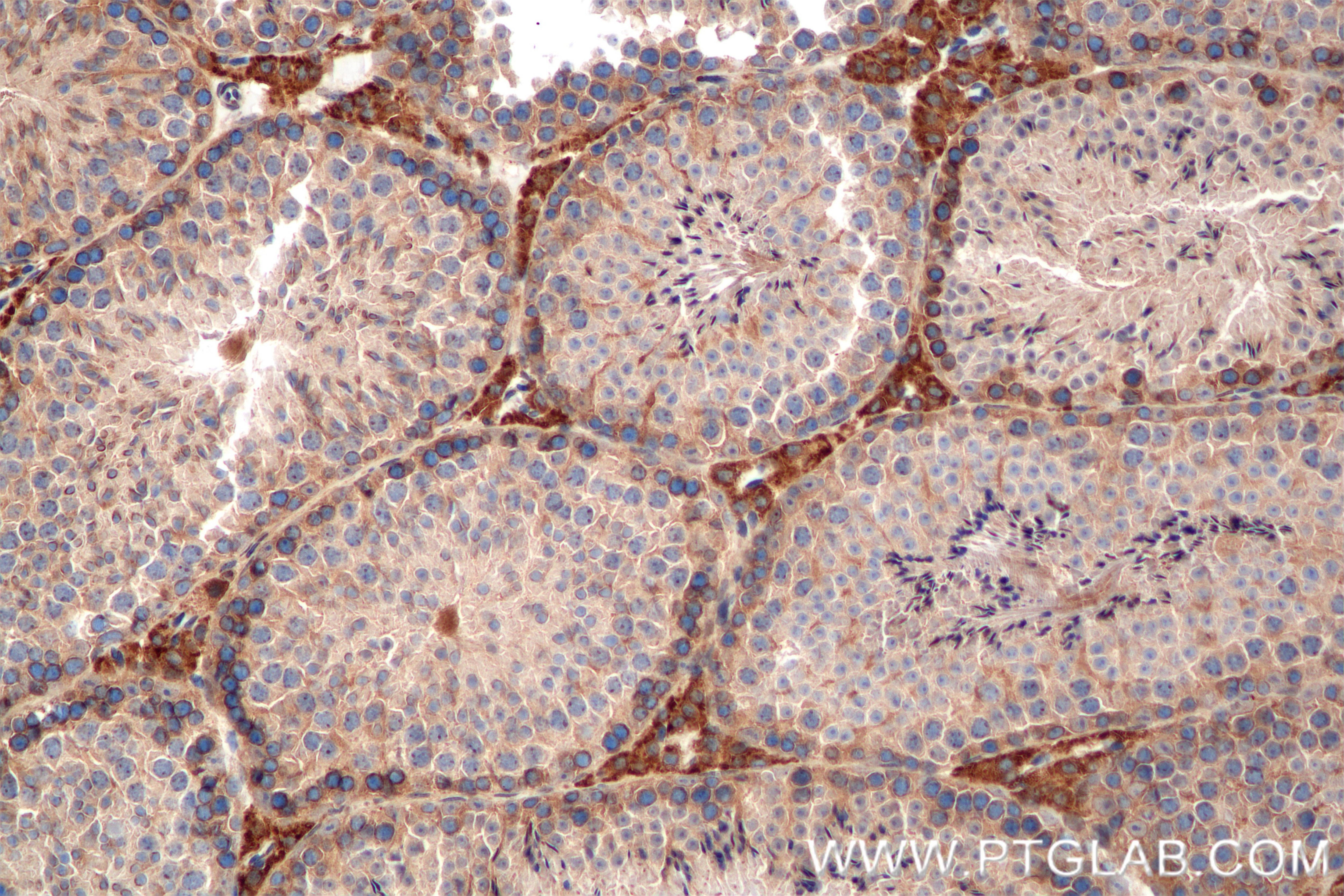 Immunohistochemical analysis of paraffin-embedded mouse testis tissue slide using 84946-5-RR (TEX264 antibody) at dilution of 1:200 (under 20x lens). Heat mediated antigen retrieval with Tris-EDTA buffer (pH 9.0). Immunohistochemistry (IHC) staining of mouse testis tissue using TEX264 Recombinant antibody (84946-5-RR)