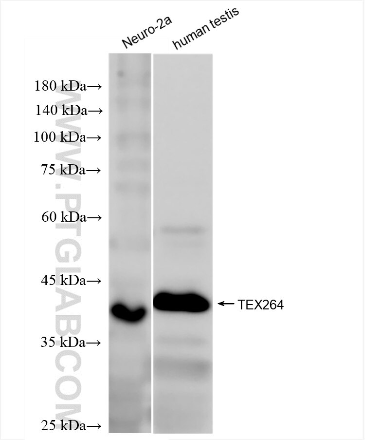 Western Blot (WB) analysis of various lysates using TEX264 Recombinant antibody (84946-5-RR)