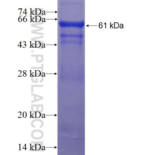 TEX264 fusion protein Ag23027 SDS-PAGE