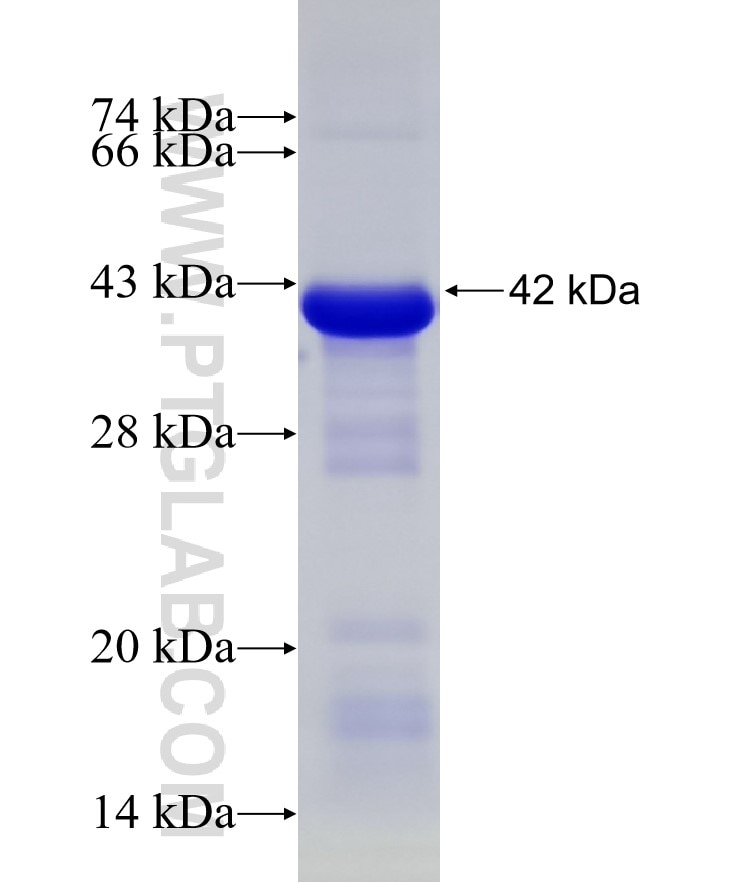 TEX264 fusion protein Ag33710 SDS-PAGE