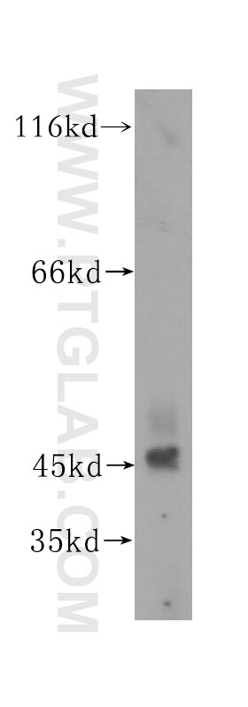 Western Blot (WB) analysis of human testis tissue using TEX28 Polyclonal antibody (16991-1-AP)