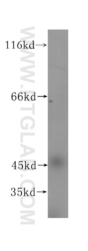Western Blot (WB) analysis of HEK-293 cells using TEX28 Polyclonal antibody (16991-1-AP)