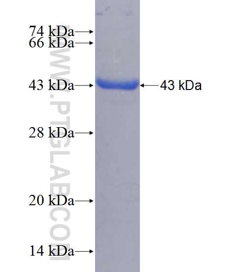 TEX28 fusion protein Ag11017 SDS-PAGE