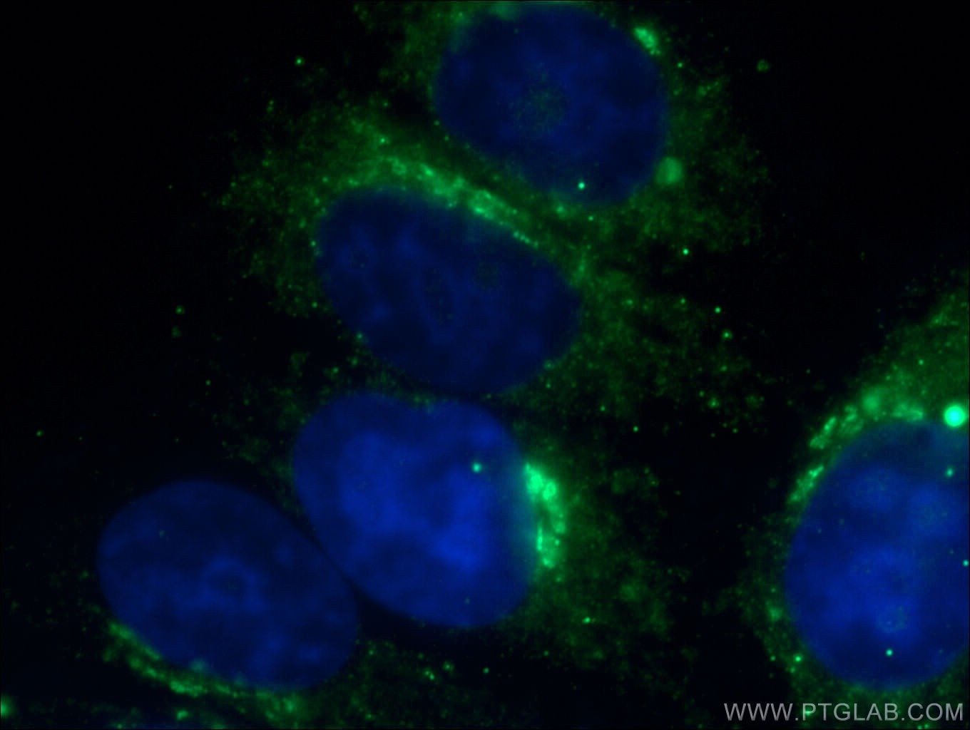 Immunofluorescence (IF) / fluorescent staining of HepG2 cells using Transferrin Polyclonal antibody (17435-1-AP)