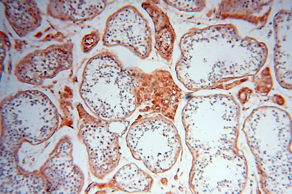 IHC staining of human testis using 17435-1-AP