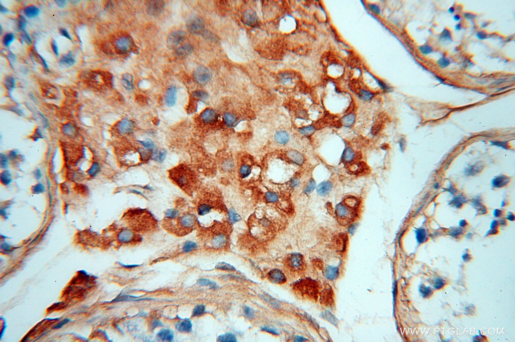 Immunohistochemistry (IHC) staining of human testis tissue using Transferrin Polyclonal antibody (17435-1-AP)