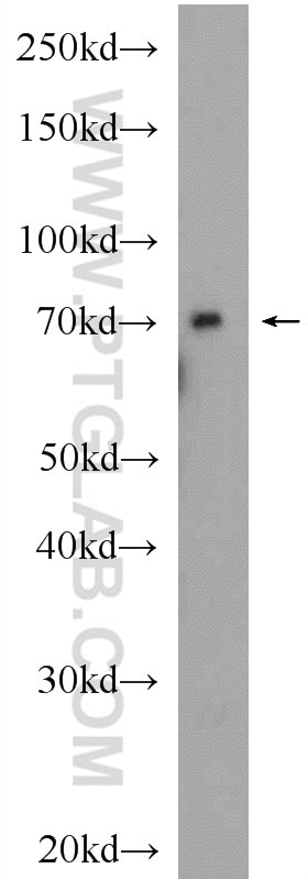 Western Blot (WB) analysis of rat kidney tissue using Transferrin Polyclonal antibody (17435-1-AP)