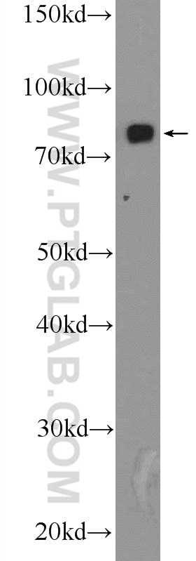 Western Blot (WB) analysis of mouse kidney tissue using Transferrin Polyclonal antibody (17435-1-AP)