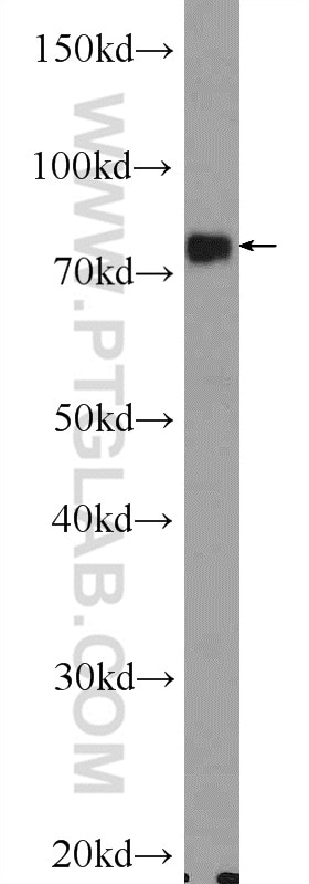 Western Blot (WB) analysis of mouse spleen tissue using Transferrin Polyclonal antibody (17435-1-AP)