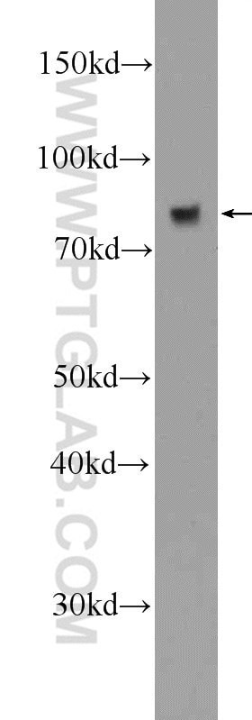 Western Blot (WB) analysis of rat kidney tissue using Transferrin Polyclonal antibody (17435-1-AP)