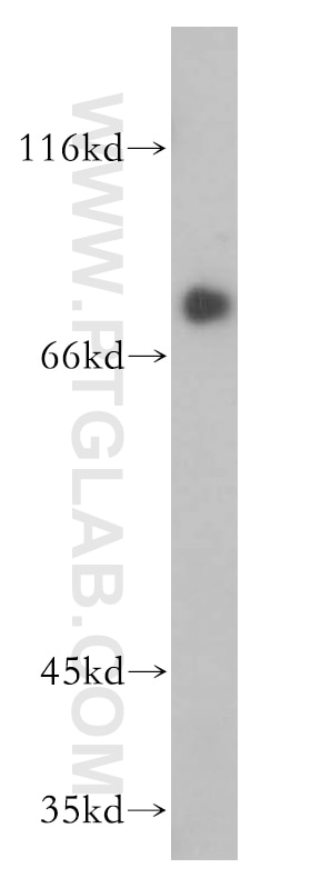 Western Blot (WB) analysis of mouse kidney tissue using Transferrin Polyclonal antibody (17435-1-AP)