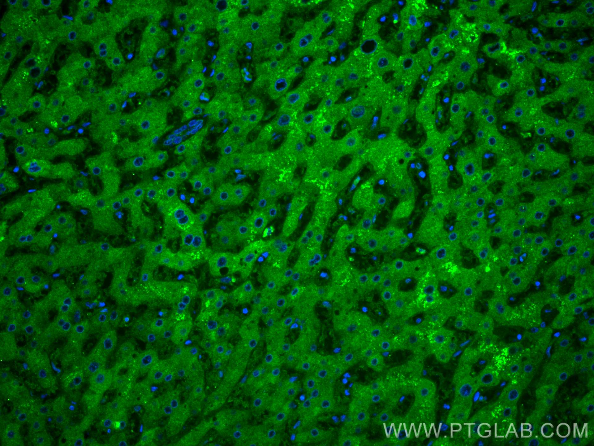Immunofluorescence (IF) / fluorescent staining of human liver tissue using Transferrin Monoclonal antibody (66171-1-Ig)