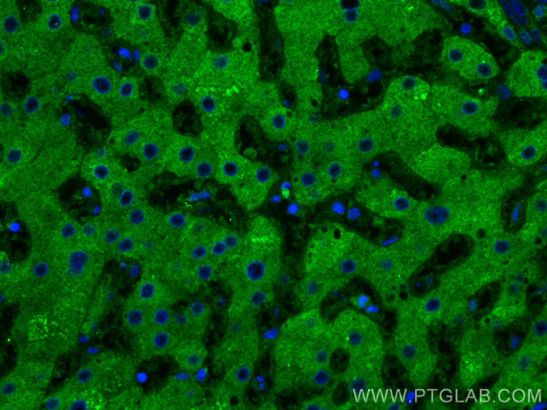 Immunofluorescence (IF) / fluorescent staining of human liver tissue using Transferrin Monoclonal antibody (66171-1-Ig)