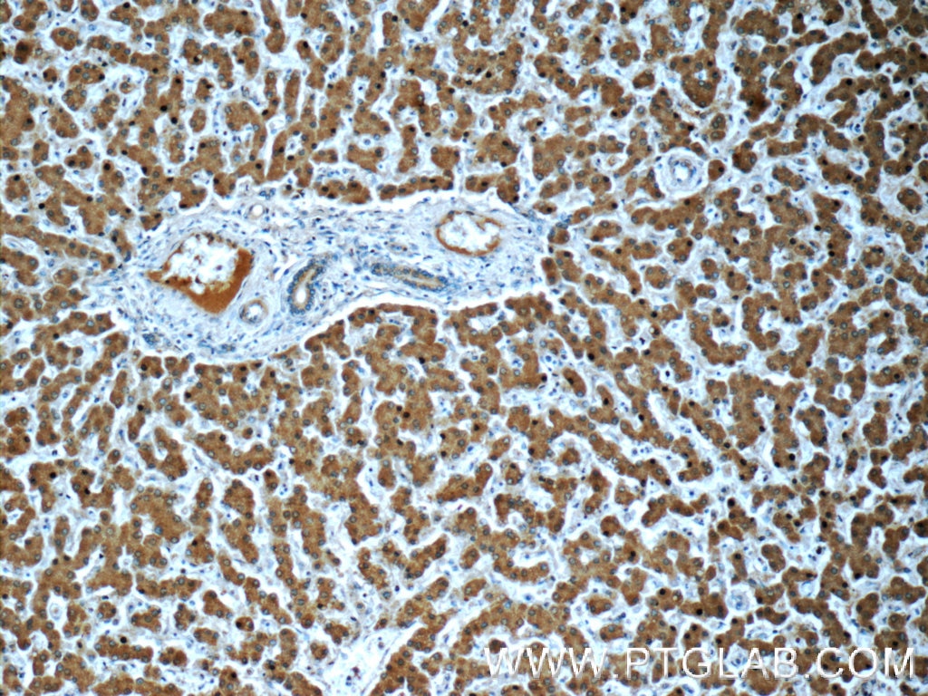 Immunohistochemistry (IHC) staining of human liver tissue using Transferrin Monoclonal antibody (66171-1-Ig)