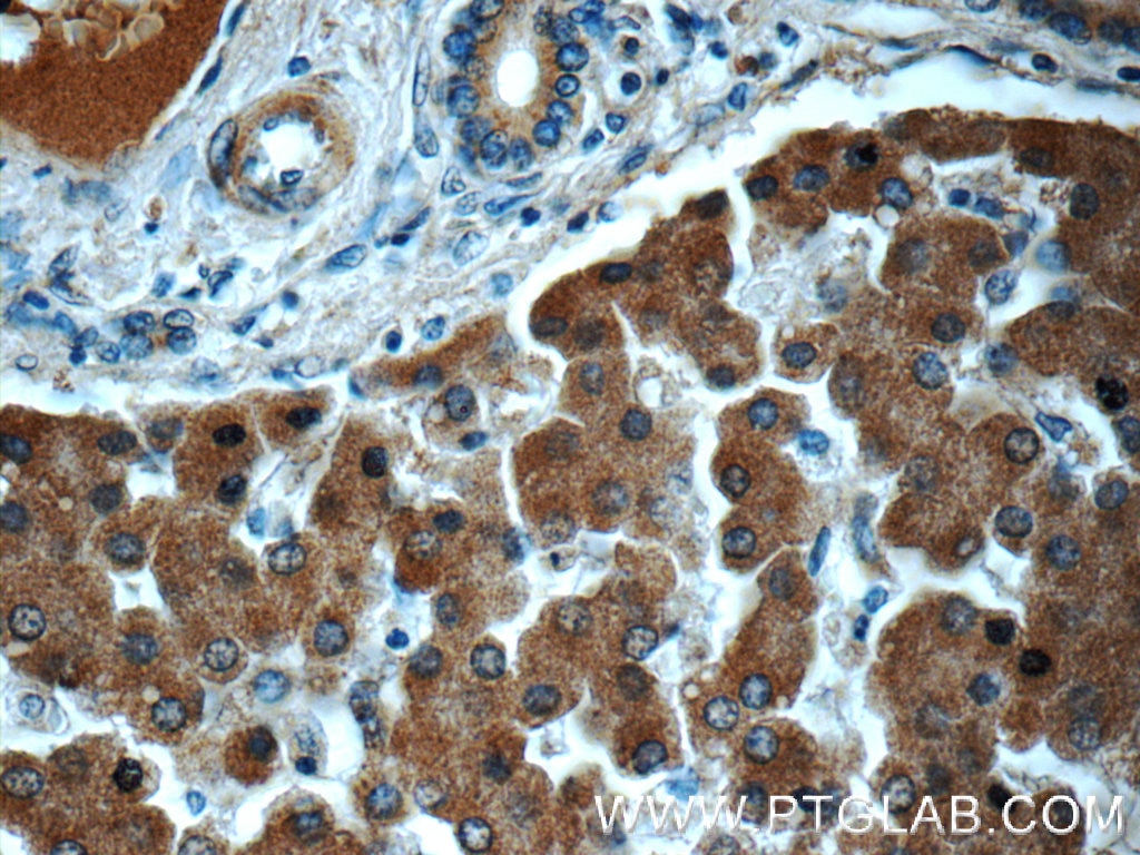 Immunohistochemistry (IHC) staining of human liver tissue using Transferrin Monoclonal antibody (66171-1-Ig)