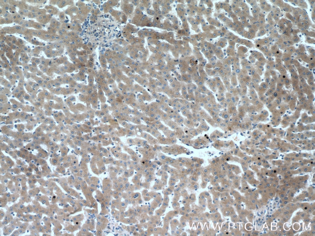 Immunohistochemistry (IHC) staining of human liver tissue using Transferrin Monoclonal antibody (66171-1-Ig)