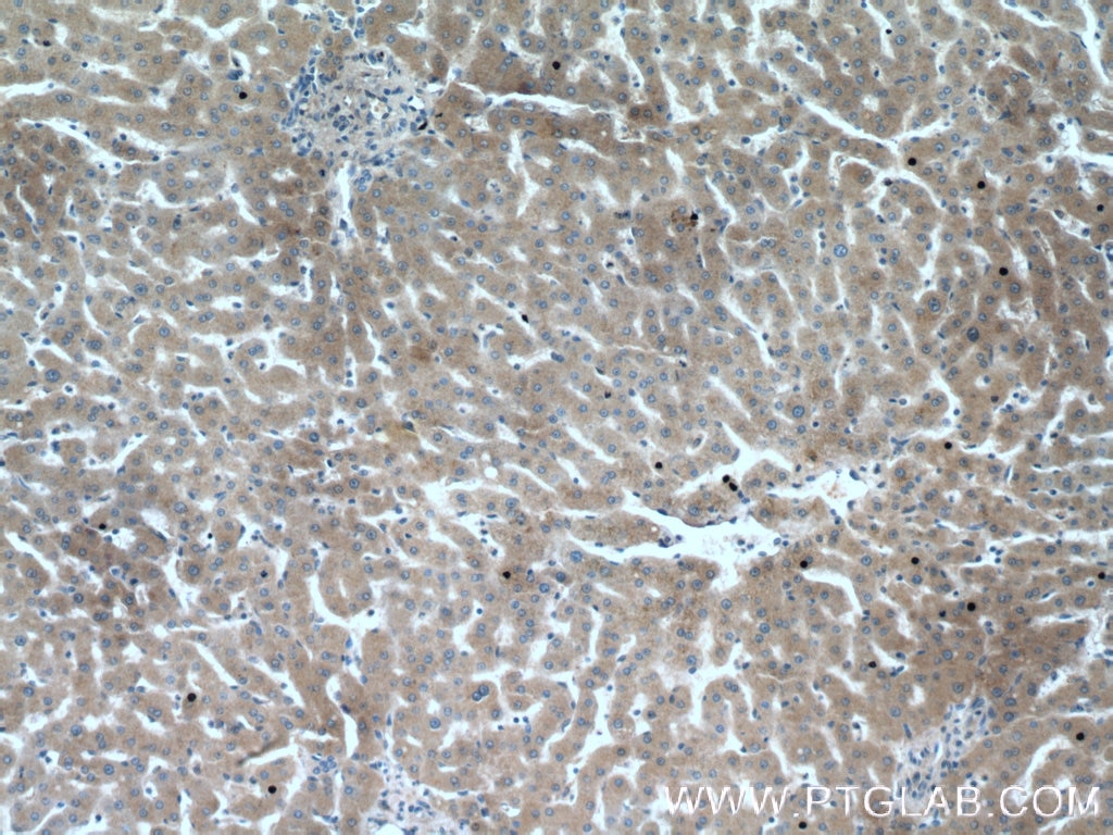 IHC staining of human liver using 66171-1-Ig