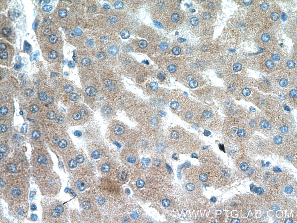 Immunohistochemistry (IHC) staining of human liver tissue using Transferrin Monoclonal antibody (66171-1-Ig)