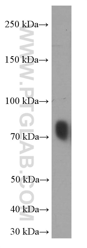 Transferrin Monoclonal antibody