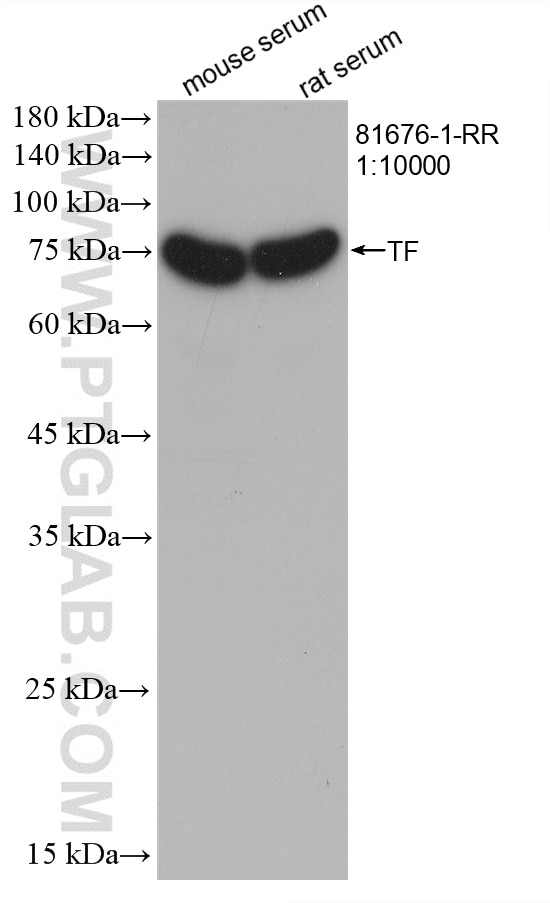 Western Blot (WB) analysis of various lysates using Transferrin Recombinant antibody (81676-1-RR)