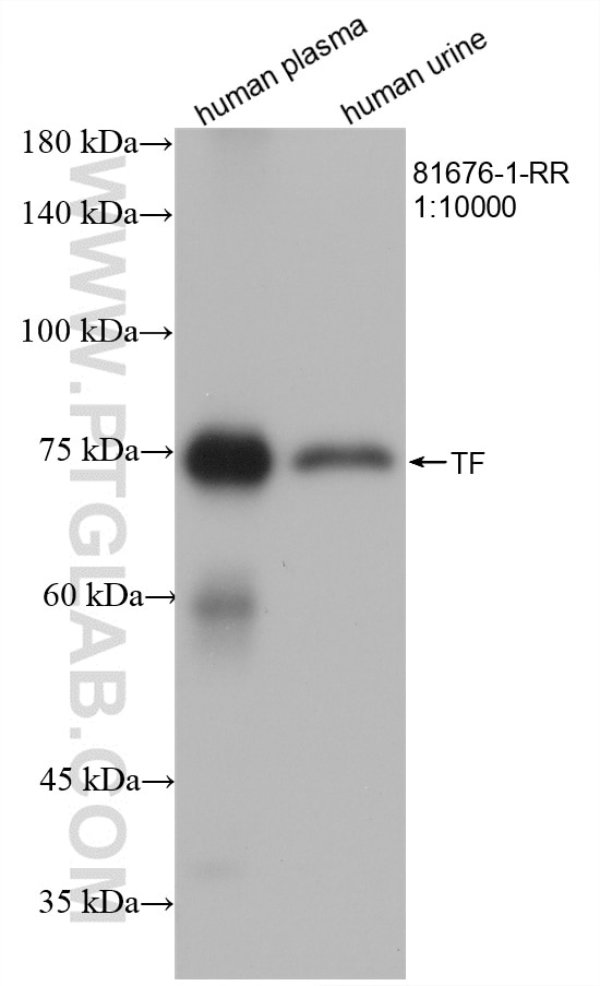 Western Blot (WB) analysis of various lysates using Transferrin Recombinant antibody (81676-1-RR)