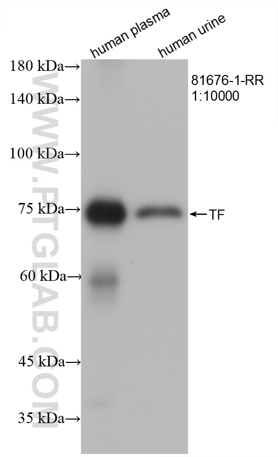 WB analysis using 81676-1-RR