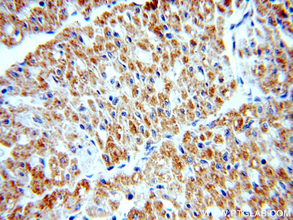 IHC staining of human heart using 19998-1-AP
