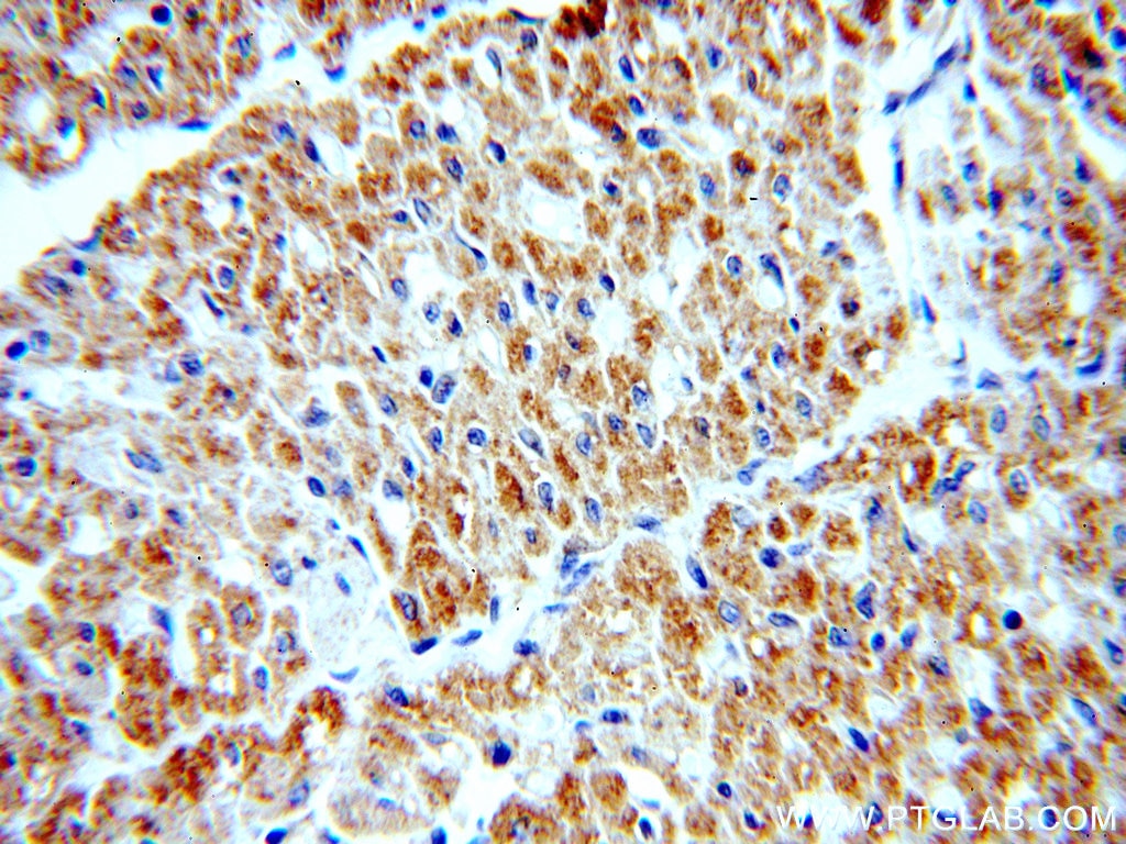 Immunohistochemistry (IHC) staining of human heart tissue using TFAM Polyclonal antibody (19998-1-AP)