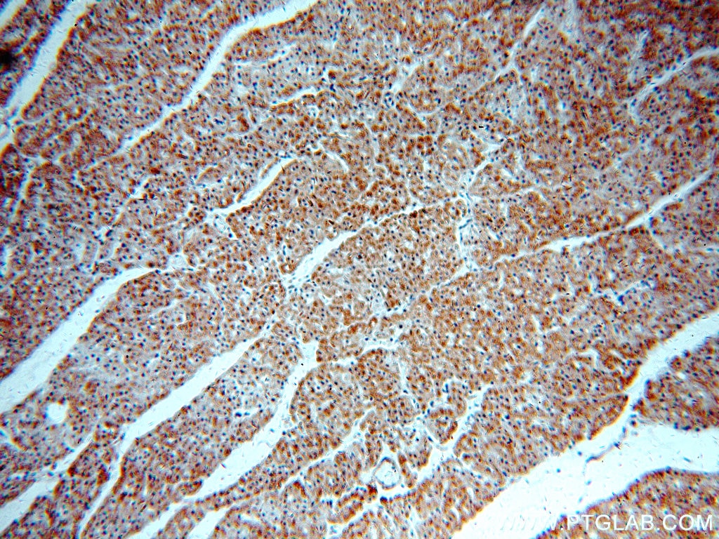 Immunohistochemistry (IHC) staining of human heart tissue using TFAM Polyclonal antibody (19998-1-AP)