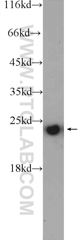 Western Blot (WB) analysis of HEK-293 cells using TFAM Polyclonal antibody (19998-1-AP)