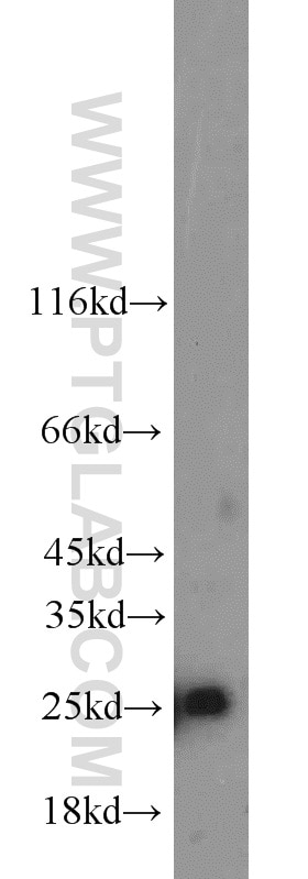 Western Blot (WB) analysis of Jurkat cells using TFAM Polyclonal antibody (19998-1-AP)