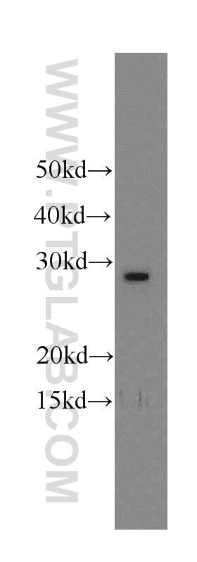 Western Blot (WB) analysis of Jurkat cells using TFAM Polyclonal antibody (19998-1-AP)