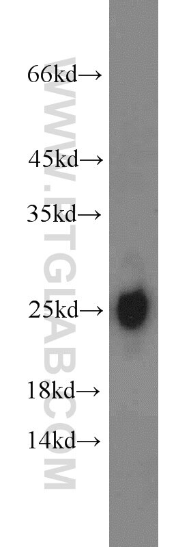 Western Blot (WB) analysis of human testis tissue using TFAM Polyclonal antibody (22586-1-AP)
