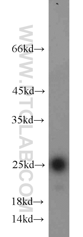 Western Blot (WB) analysis of A431 cells using TFAM Polyclonal antibody (22586-1-AP)